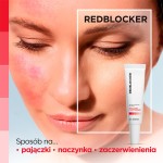 RedBlocker Spot Serum für empfindliche und gefäßreiche Haut Tag und Nacht 30 ml