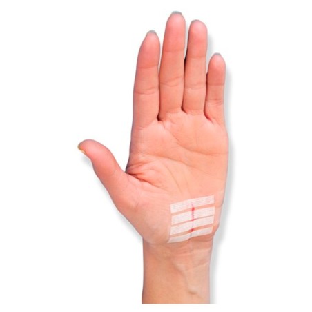 Viscoplast Steri-Strip Strisce per chiusura di ferite, bianche, 2 misure, 8 pezzi