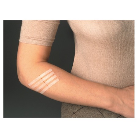 Viscoplast Steri-Strip Strisce per chiusura di ferite, bianche, 2 misure, 8 pezzi