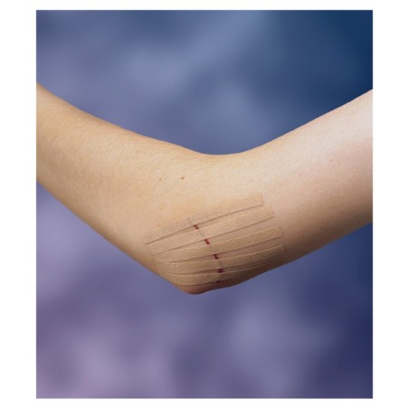 Viscoplast Steri-Strip Tiras para cierre de heridas color carne 6 mm x 75 mm 6 piezas